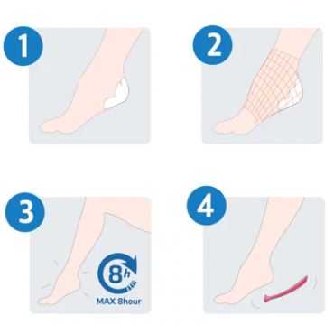 FOOT MOIST PATCH Intezivna nega za stopala